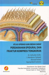 Image of Atlas operasi ilmu bedah saraf : perdarahan epidural & fraktur kompresi tengkorak