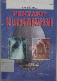 Image of penyakit saluran pernapasan