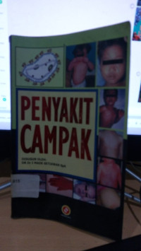 Image of Penyakit campak/harsono salimo