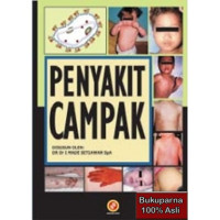 Image of PENYAKIT CAMPAK